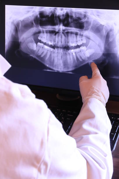 Best Emergency Tooth Extraction in Jarales, NM
