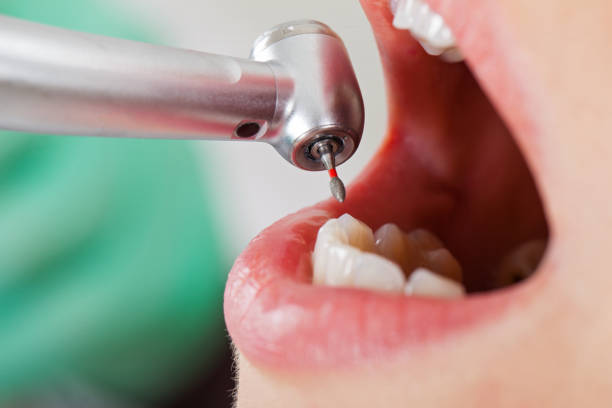 Best Same-Day Emergency Dentist in Jarales, NM